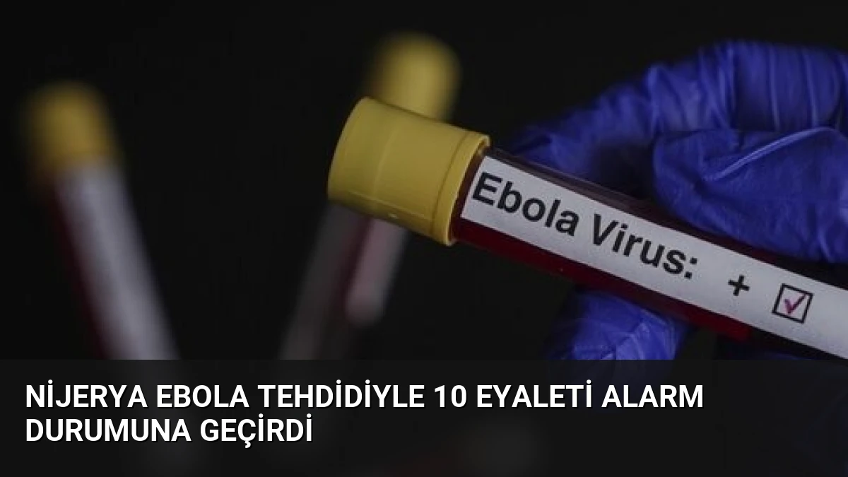 Nijerya Ebola Tehdidiyle 10 Eyaleti Alarm Durumuna Geçirdi